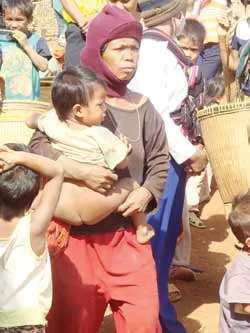 Làng phong Ia Kriêng - Những mảnh đời buồn... ảnh 2