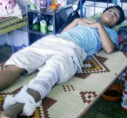 Quảng Nam: Một thầy giáo đánh học sinh rạn xương đùi