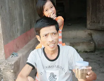 Ăn cóc độc để chữa ung thư: Thêm hai trường hợp thoát án tử
