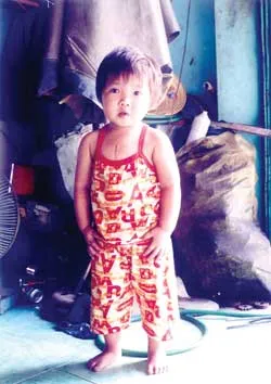 Một cháu bé mang nhiều chứng bệnh hiểm nghèo
