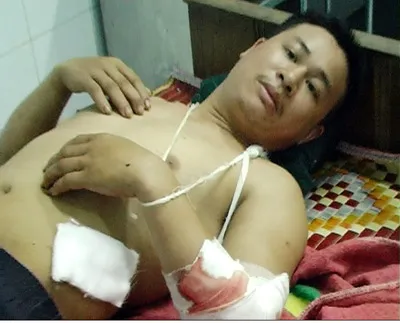 Quảng Nam: Đánh nhau tại bãi vàng, 1 người chết, 1 người bị thương