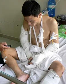 Hơn 16 năm tù cho 3 côn đồ chém cơ thủ bi da Lê Dũng