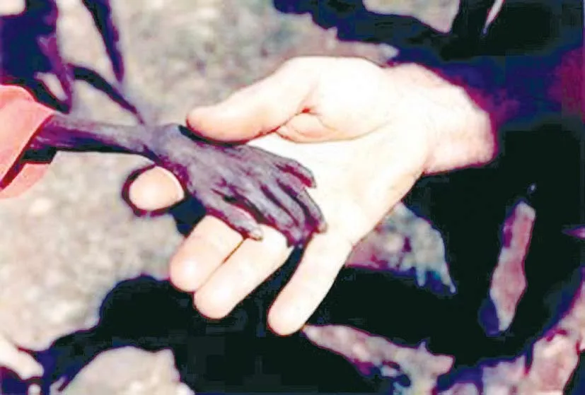 Hai mặt của thế giới hiện nay