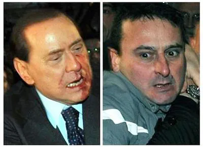 Thủ tướng Italia Silvio Berlusconi bị tấn công