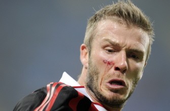 David Beckham is injured on his right cheek during the Italian Serie A football match AC Milan against Chievo on March 14, 2010 at San Siro Stadium in Milan. AFP photo