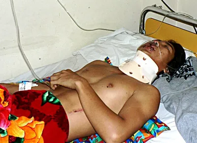 Chấn thương nghiêm trọng do bị truy đuổi