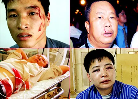 Hành hung, cản trở nhà báo đang tác nghiệp: Chống người thi hành công vụ hay cố ý gây thương tích?