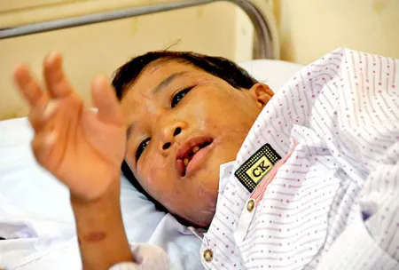 Cháu Hào Anh tại bệnh viện chiều 12-5. Ảnh: THÁI BẰNG
