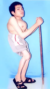 Ảnh 2