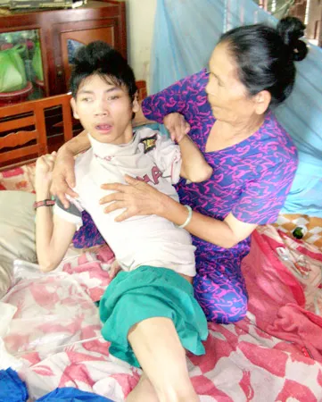 Vẫn còn hàng triệu người Việt Nam bị di chứng nặng nề do chất độc da cam/ dioxin. Ảnh: T.N.