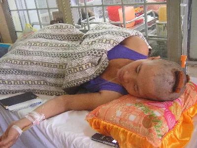 Chị Phương đang được điều trị tại bệnh viện. Ảnh: Công Hoan