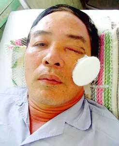 Xích mích nhỏ, thương tật lớn