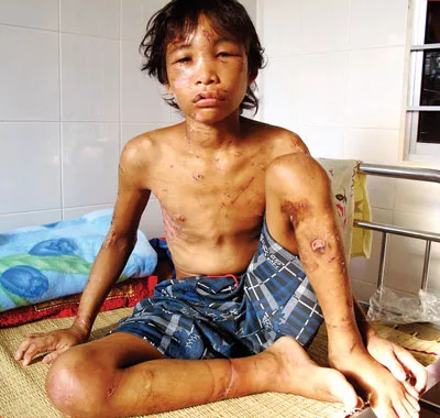 Nội dung buổi giao lưu trực tuyến: Chống bạo hành trẻ em và bạo lực học đường ảnh 3