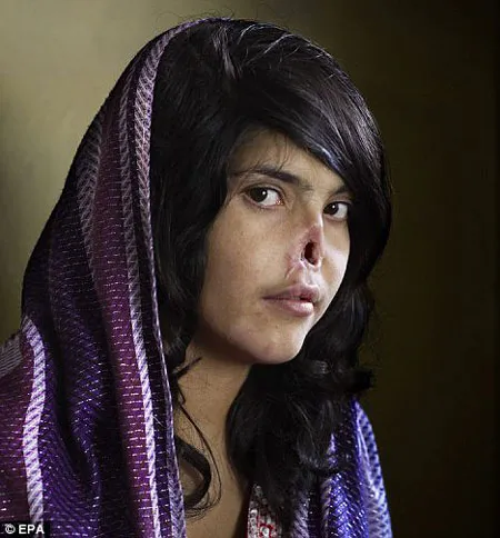 Bức chân dung Bibi Aisha bị cắt mũi gây sốc đối với cộng đồng quốc tế.