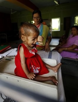 In this photo taken Wednesday, April 13, 2011, one year and 9-month-old Sania cries as she is weighed only 5 kilograms (11 pounds) on a scale after eating a meal at a ward for malnourished children at a government hospital in Morena in the Central Indian State of Madhya Pradesh