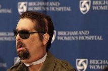 Face transplant recipient, Dallas Wiens, speaks at a press conference in Boston, Massachusetts