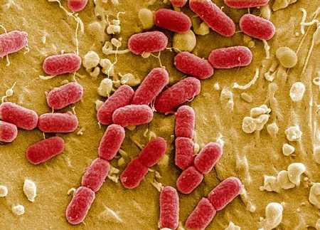Thái Lan: Phát hiện trái bơ nhập khẩu từ châu Âu nhiễm khuẩn E.coli