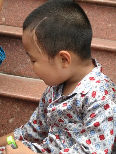 Cháu Vinh với vết sẹo trên thái dương