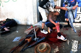 A National Transitional Council (NTC) fighter screams in pain after getting wounded from a mortar fired by forces loyal to Moamer Kadhafi in Sirte on October 12, 2011