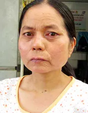 Thêm một cô gái 27 tuổi “biến” thành bà lão