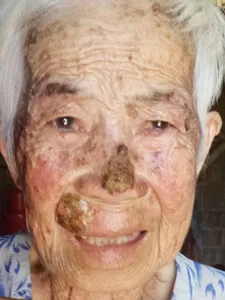 Xin giúp bà Tư Kén