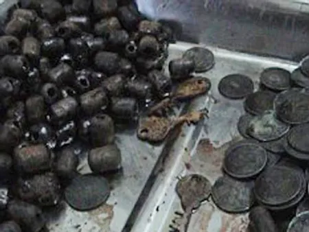 Hàng trăm đồng xu, viên sắt, chìa khóa…tổng cộng 6kg, được lấy ra từ dạ dày của Singh