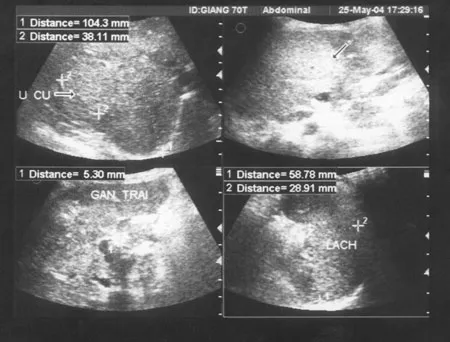 Hoạt chất curcumin trong cây nghệ vàng có tác dụng hủy diệt tế bào ung thư ảnh 4