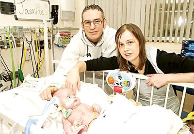 Bệnh nhân nhỏ nhất được phẫu thuật tim hở