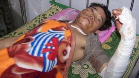 A victim in the accident (photo Vietnamnet).