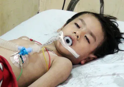 Vụ cháy nhà dân tại Bạc Liêu: Cháu bé còn lại đã chết