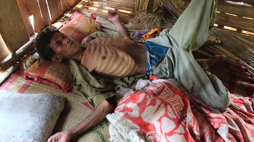 Pham Van Nhoc dies on May 7 from the mysterious skin disease (Photo: Tuoi tre)