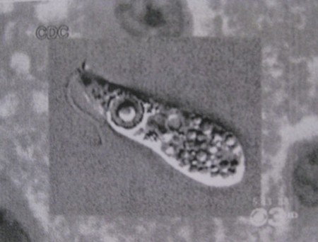 ‘Naegleria Fowleri’, the brain-eating amoeba, under a microscope