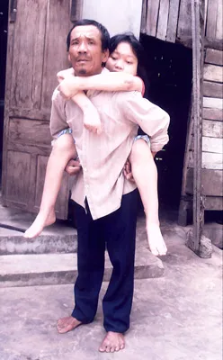 Xin giúp cô gái trẻ bị bệnh hiểm nghèo