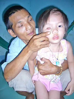 Xin cứu cháu bé khỏi mất thêm mắt nữa