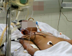 The man in intensive care room
