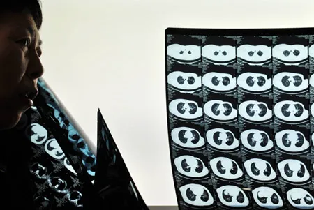 1/5 người già Trung Quốc có nguy cơ bị ung thư