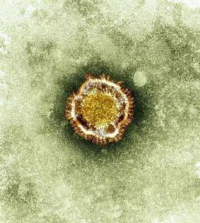 Ca tử vong thứ 9 của virus mới dòng SARS