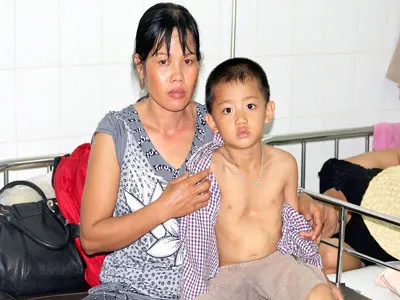 Cháu bé bị lõm ngực ép tim sống theo công trường bê tông 6