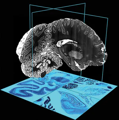 Mô hình 3D đầu tiên về não người