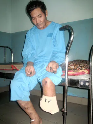 Bác Được bỗng trở thành tàn phế
