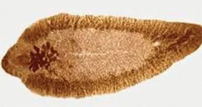 Sán lá gan lớn. Ảnh: T.L.