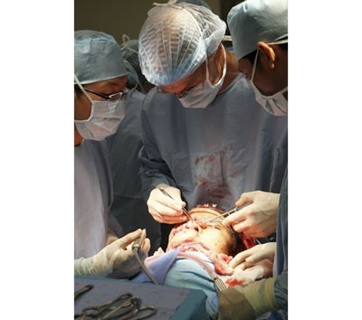 Doctors performing a surgery on Thien An (Photo: SGGP)