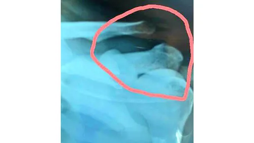 Kết quả chấn thương của Thanh Hải được anh chia sẻ trên trang cá nhân. Ảnh: T.H