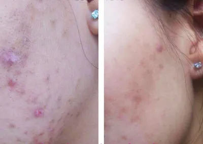 Thị trường mỹ phẩm: Vàng thau lẫn lộn