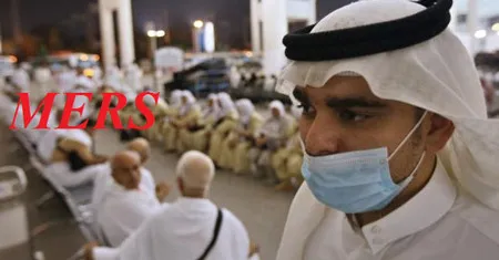 Ca tử vong đầu tiên do nhiễm MERS ở Algeria