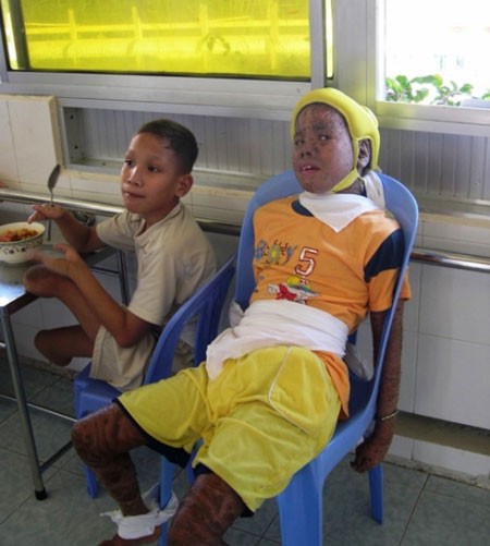 The young third generation Agent Orange victims in Vietnam (Photo: Sggp)