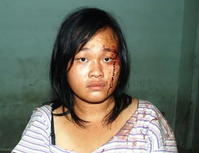 Bắt giữ nhóm chuyên cướp giật tại khu phố Tây