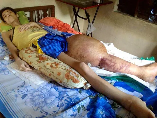 Sự sống mong manh của một sinh viên nghèo