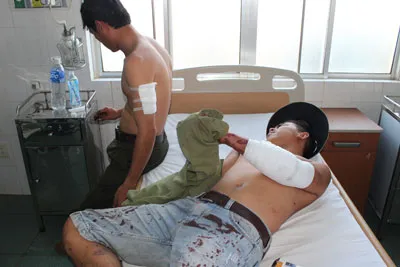 3 nhân viên bảo vệ rừng bị chém phải nhập viện