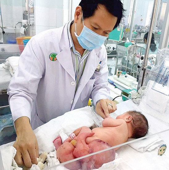 Dr. Truong Quang Dinh examines the baby girl before the operation (Photo: SGGP)